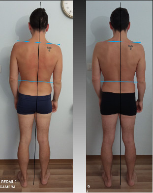 Percorso integrato di Osteopatia e Pilates Reformer